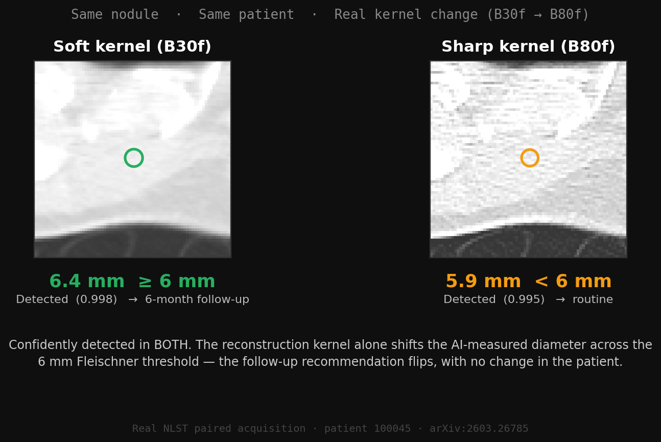 Real paired NLST CT: the same nodule confidently detected under both reconstruction kernels, but the kernel alone shifts the AI-measured diameter across the 6mm Fleischner threshold, flipping the follow-up recommendation